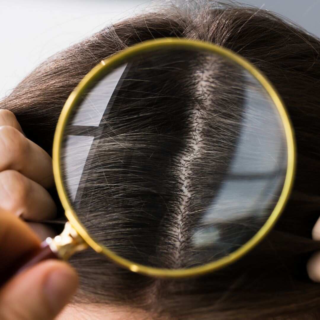 Hairfall Reduction Diet